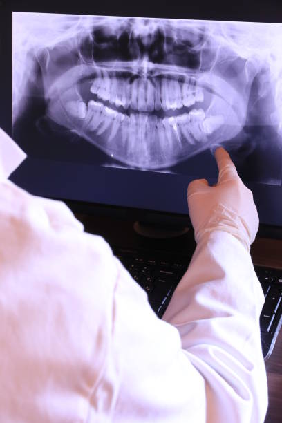 Best Emergency Dentist for Lost Fillings or Crowns in Madison, NC