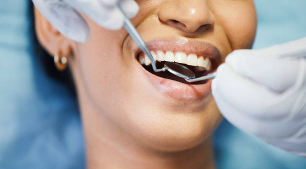 Best Emergency Dental Services for Seniors in Madison, NC